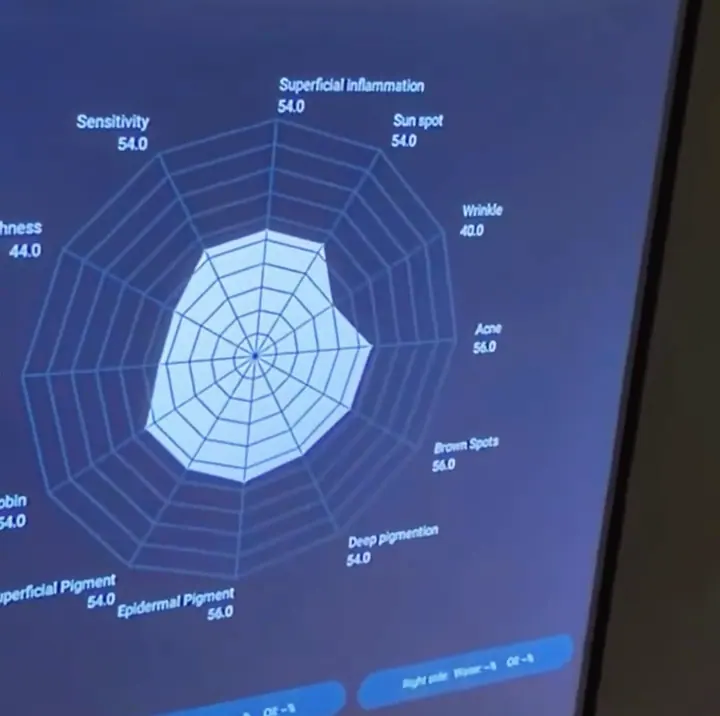 The skin analysis readout on screen during an assessment.